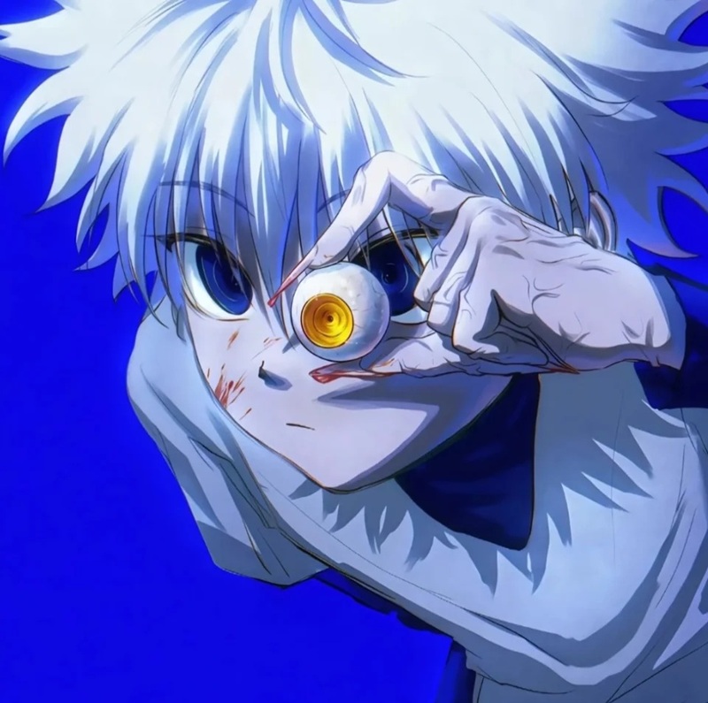avatar killua 31