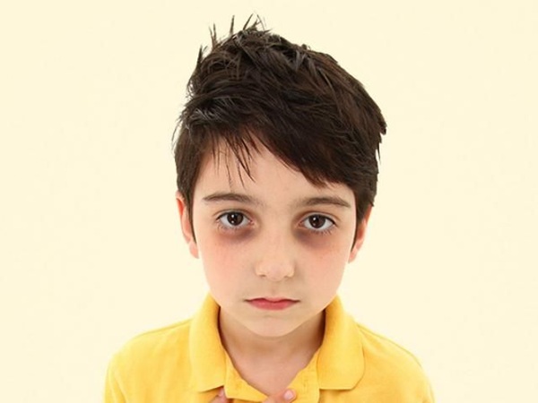 ảnh meme mắt thâm