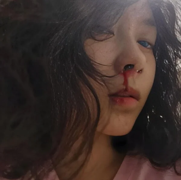 meme xịt máu mũi 19