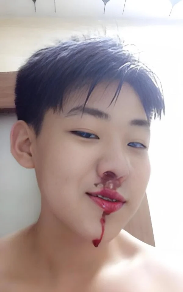 meme xịt máu mũi 3