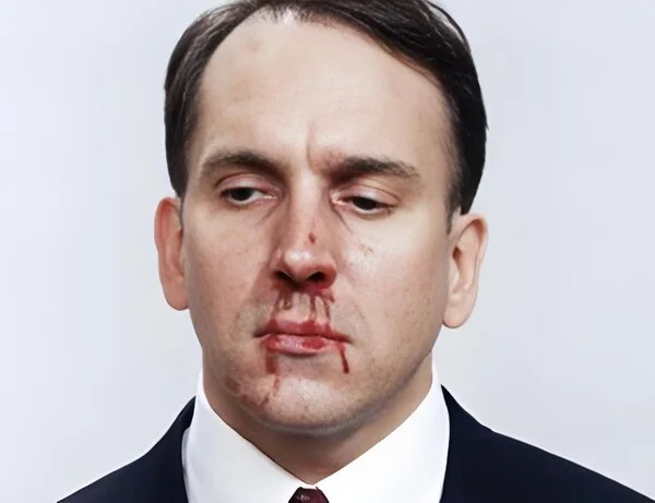 meme xịt máu mũi 6