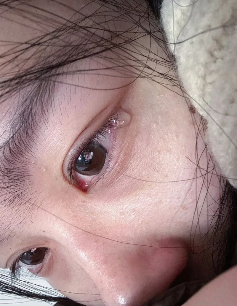 ảnh girl buồn 19