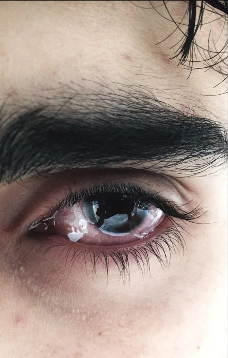 ảnh mắt khóc 31