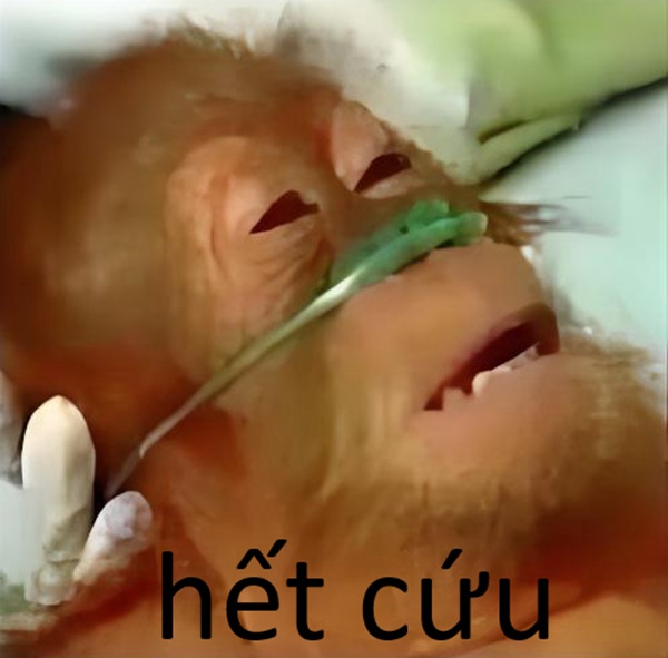 ảnh meme hết cứu 5